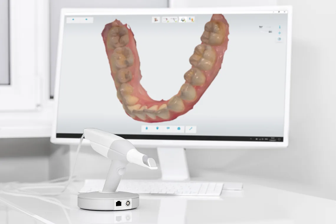 Cómo aumentar la facturación de una clínica dental a través del escáner intraoral